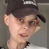 TikTok star Bella Bradford, 24, announces death from cancer in final video message | World News